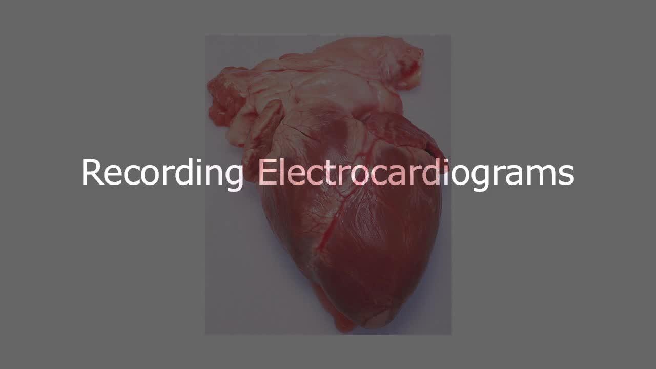 ECG | Channels for Pearson+