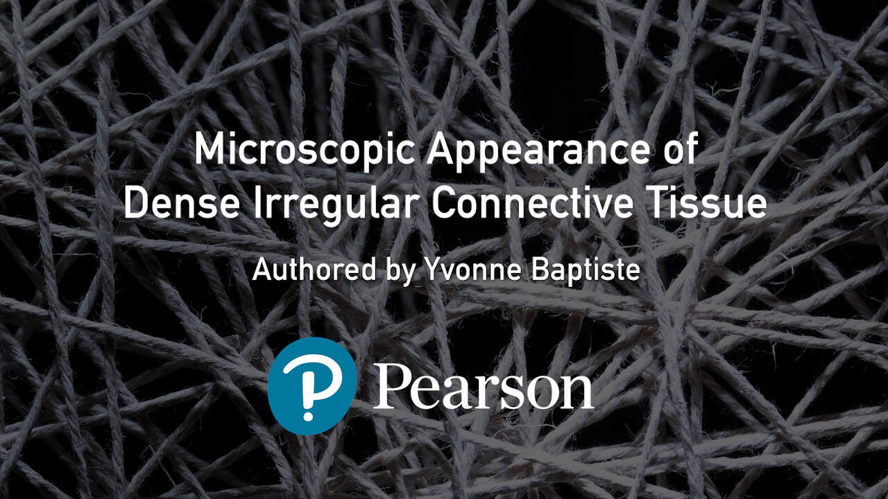 Dense Irregular Connective Tissue
